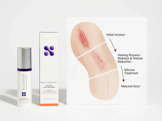 Mohs and Facial Surgery Scars