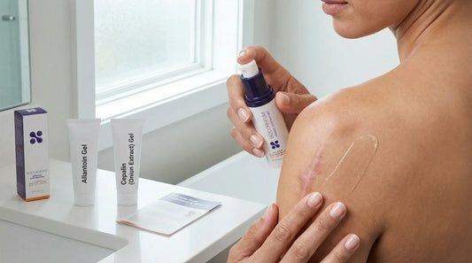 allantoin vs silicone for scars