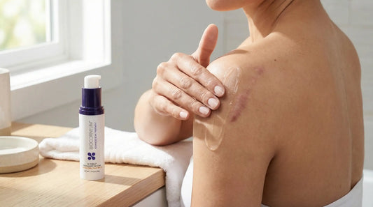 keloid scar treatment