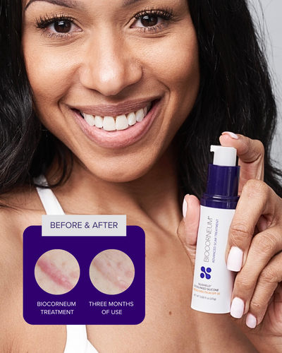 BIOCORNEUM SiliShield Advanced Scar Gel Before/After 
